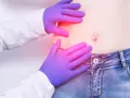 Lekarz bada brzuch, sprawdzając, po której stronie jest wyrostek.