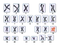 Kariotyp przedstawia pary chromosomów, w tym wyróżnione na czerwono chromosomy płciowe.