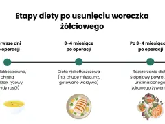 Etapy diety po usunięciu woreczka żółciowego: od płynnej, lekkostrawnej, przez niskotłuszczową, do stopniowego powrotu do zdrowego żywienia.
