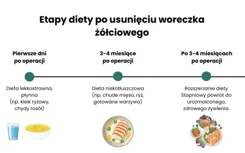 Etapy diety po usunięciu woreczka żółciowego: od płynnej, lekkostrawnej, przez niskotłuszczową, do stopniowego powrotu do zdrowego żywienia.