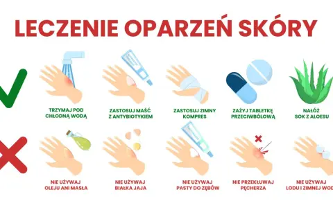 Leczenie oparzeń skóry: chłodna woda, maść z antybiotykiem, zimny kompres, tabletki przeciwbólowe, aloes. Unikaj masła, jajka, pasty do zębów, lodu. Nie przekłuwaj pęcherza.