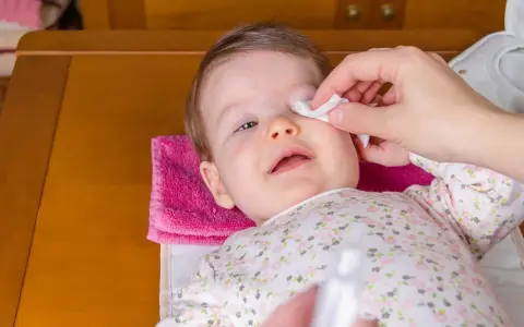 Delikatne przemywanie oka niemowlaka wacikiem nasączonym solą fizjologiczną.