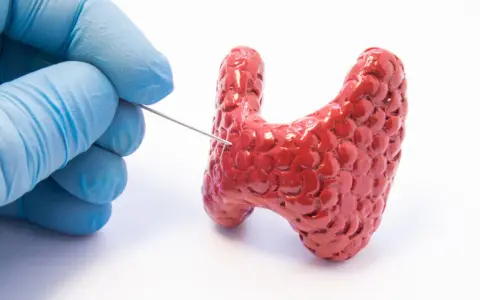 Ręka w niebieskiej rękawiczce wykonuje biopsję tarczycy, pobierając próbkę z czerwonego modelu gruczołu.