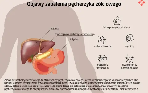 Anatomia człowieka z zaznaczonym pęcherzykiem żółciowym i objawami jego zapalenia: ból, wzdęcia, wymioty, problemy z trawieniem.