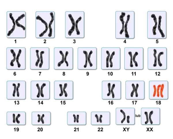 Kariotyp przedstawia pary chromosomów, w tym wyróżnione na czerwono chromosomy płciowe.