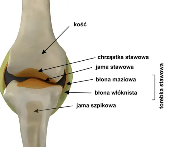 Przekrój stawu z widocznymi kośćmi, chrząstką, jamą stawową, błoną maziową i włóknistą, tworzącymi torebkę stawową.