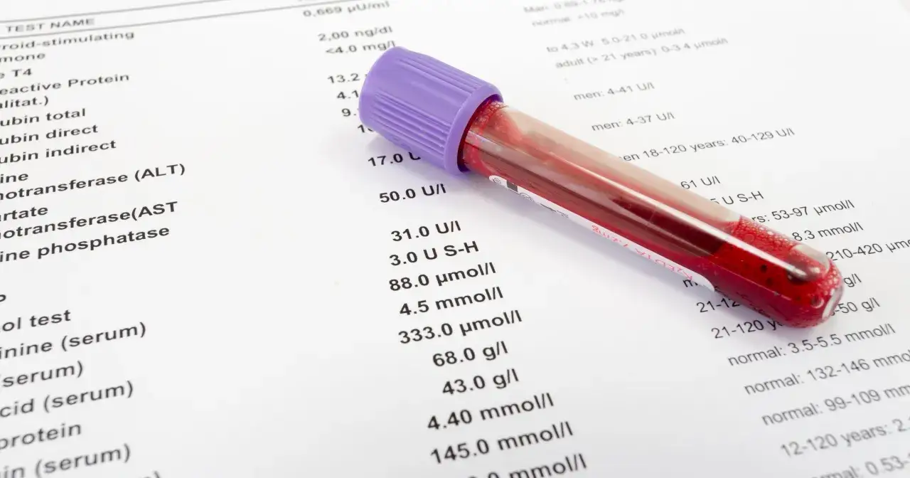 Wyniki badań krwi z próbówką. Na papierze widnieją nazwy testów i wartości, w tym 