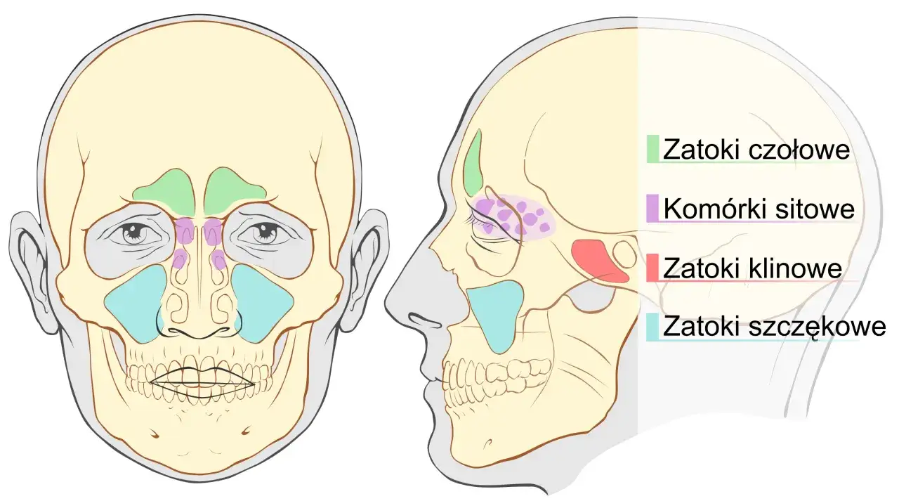 Ilustracja zatok przynosowych, które mogą wymagać leczenia antybiotykiem. Widoczne zatoki czołowe, komórki sitowe, zatoki klinowe i szczękowe.