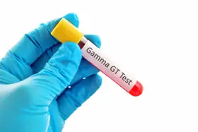 Rękawiczka w niebieskiej rękawiczce trzyma probówkę z krwią do badania Gamma GT. Wynik: ggtp podwyższone.