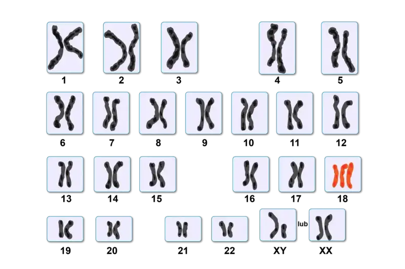 Kariotyp przedstawia pary chromosomów, w tym wyróżnione na czerwono chromosomy płciowe.